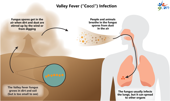 ValleyFever